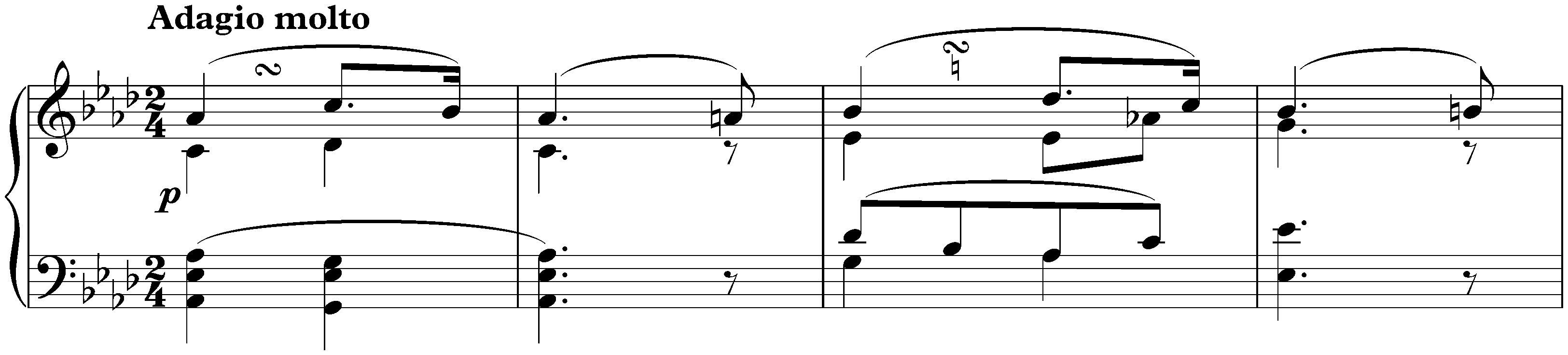 Sonata no. 5 in C minor, op. 10 no. 1; 2. Adagio molto