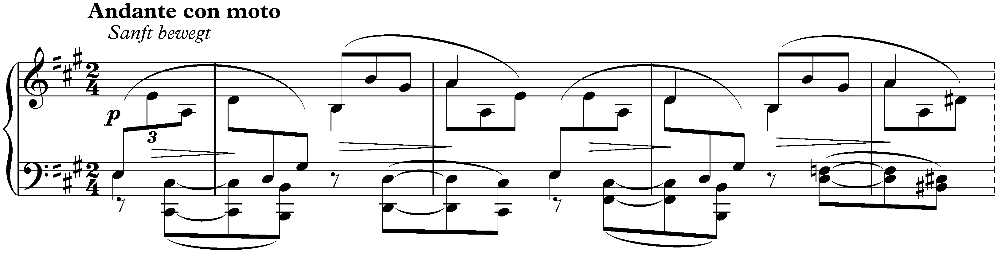 Eight Pieces, op. 76; 6. Intermezzo in A major