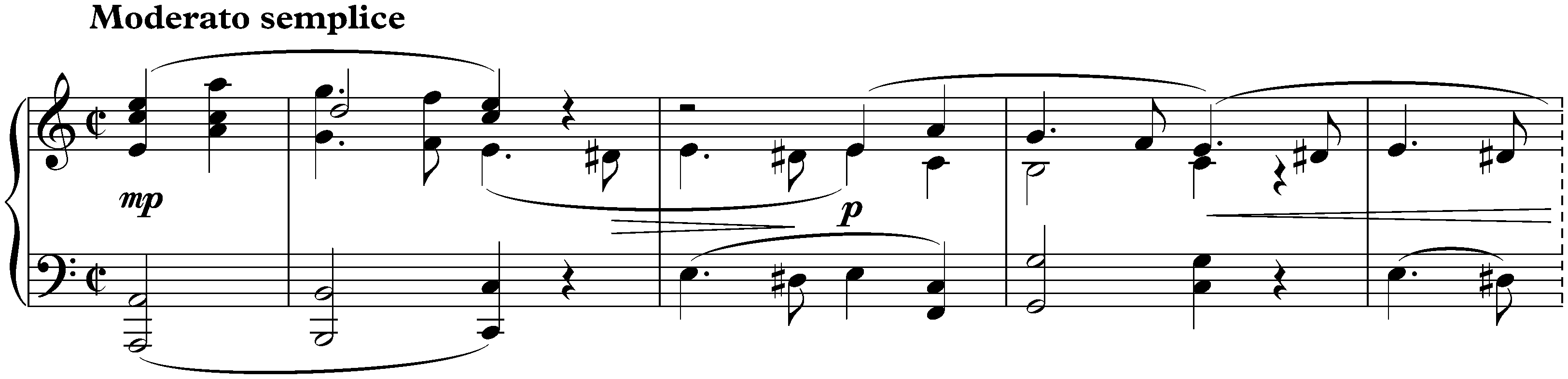 Eight Pieces, op. 76; 7. Intermezzo in A minor