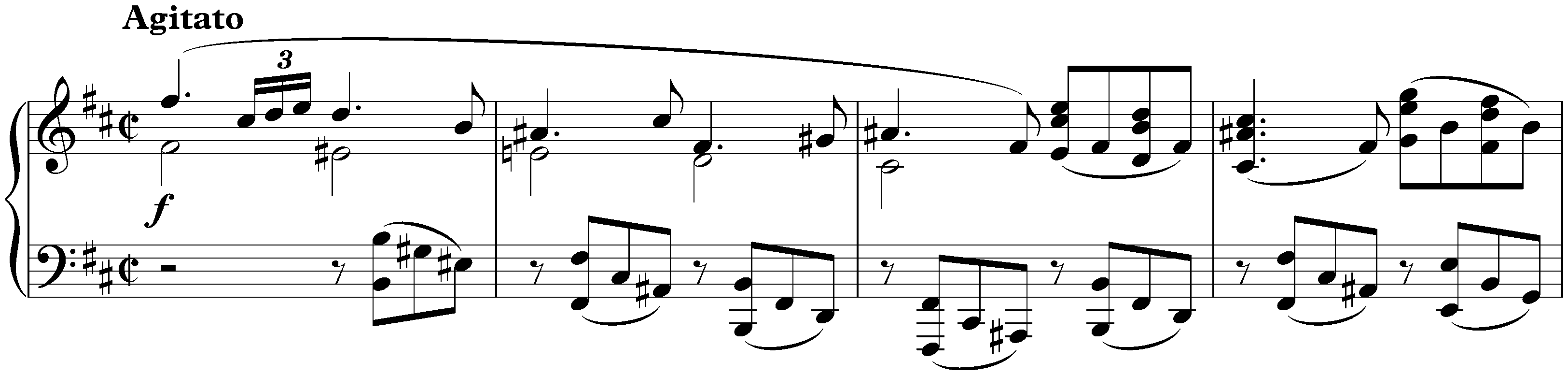 Two Rhapsodies, op. 79; 1. B minor