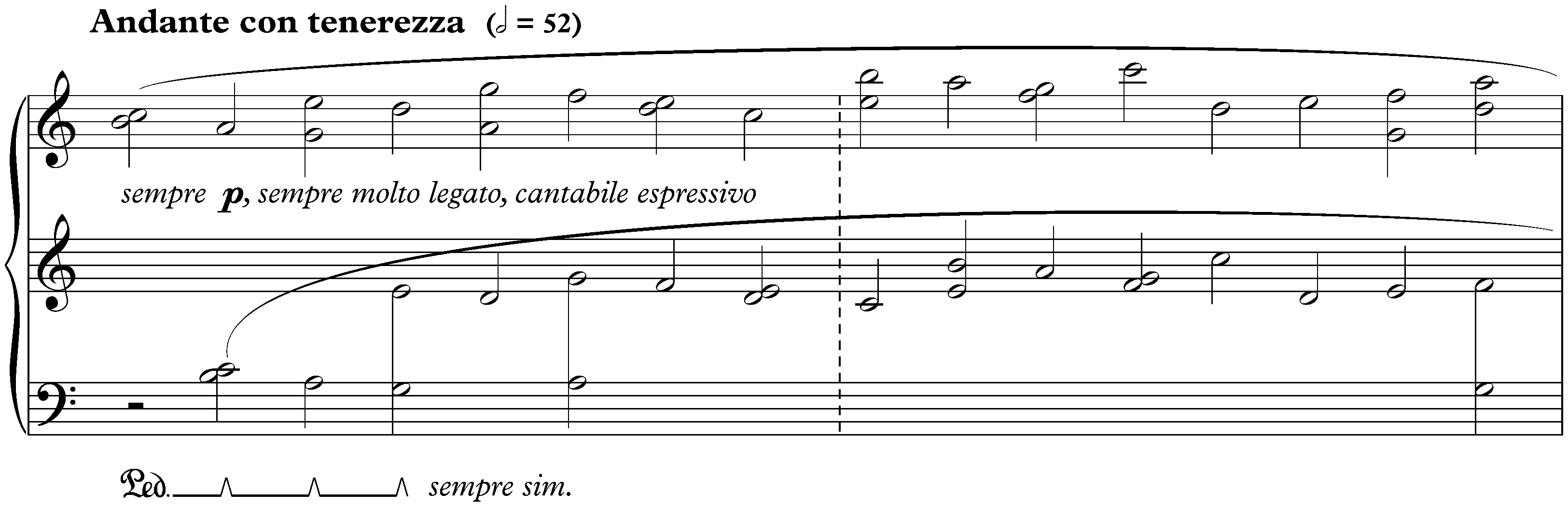 Études, Book 3; 15. White on White