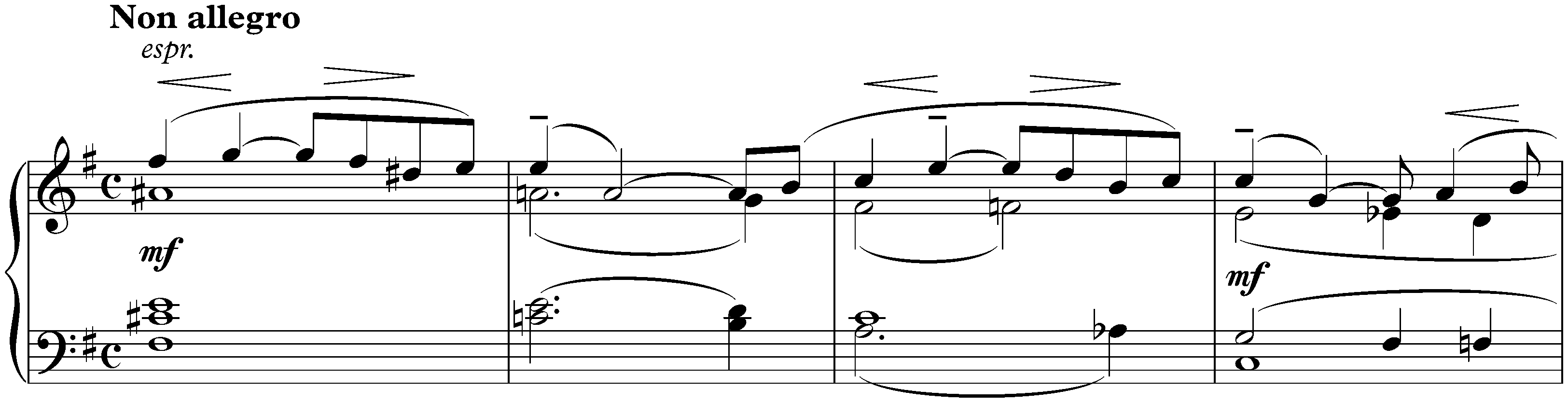 Sonata no. 2 in B-flat minor, op. 36 (first version); 2. Non allegro – Lento