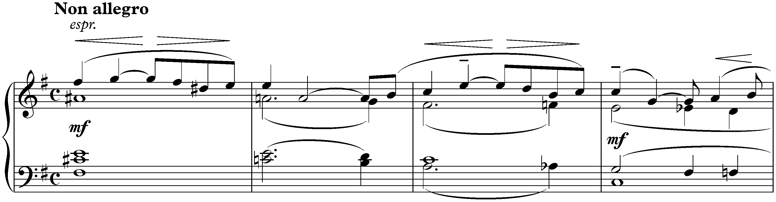 Sonata no. 2 in B-flat minor, op. 36 (second version); 2. Non allegro – Lento