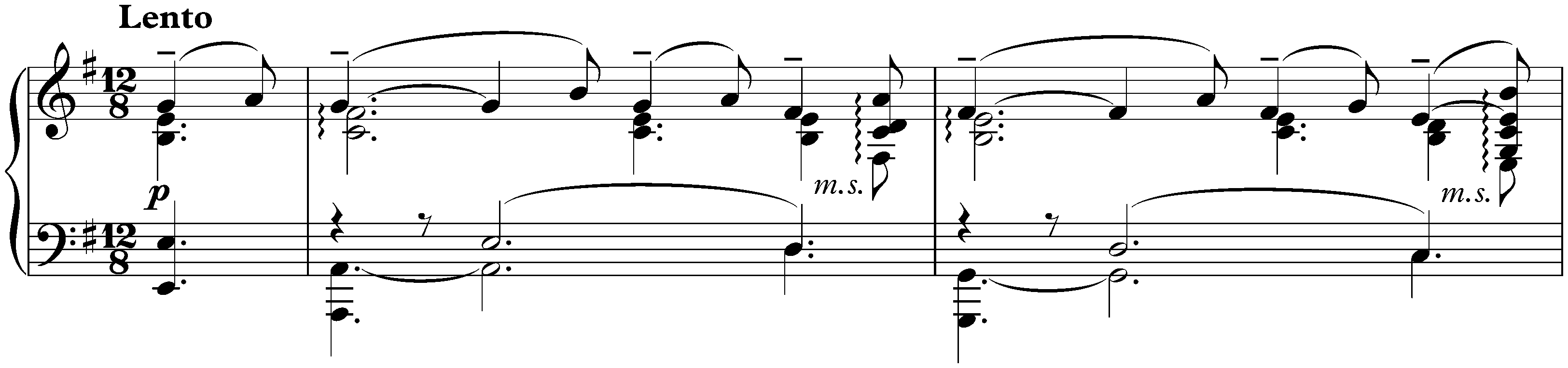 Sonata no. 2 in B-flat minor, op. 36 (second version); 2. Non allegro – Lento
