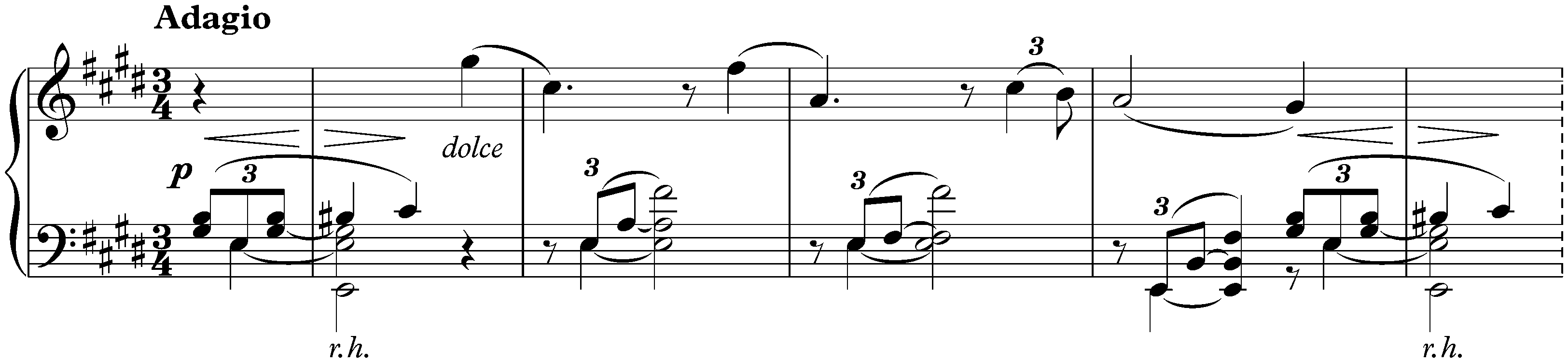 Seven Fantasies, op. 116; 4. Intermezzo in E major