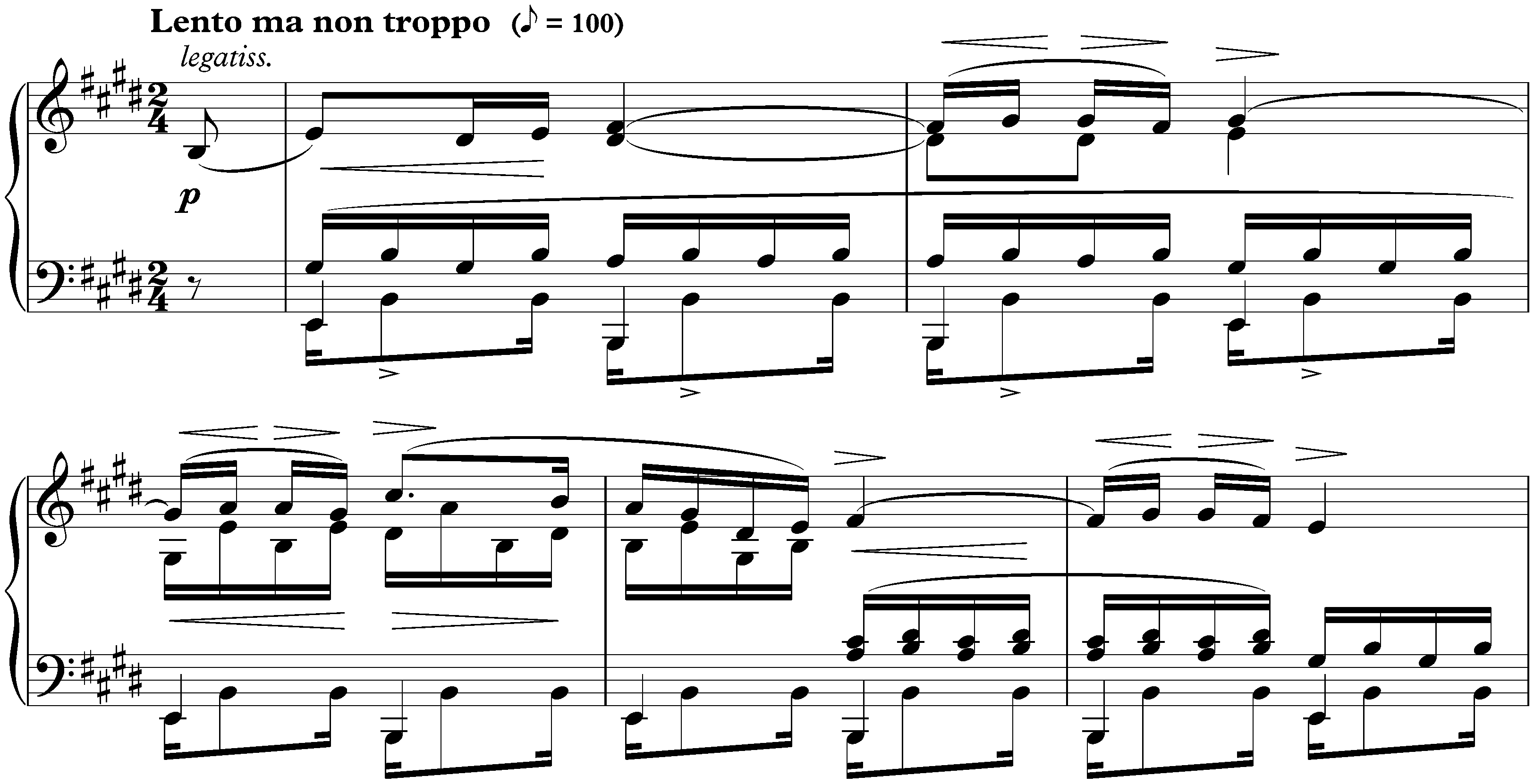 Twelve Études, op. 10; 3. E major