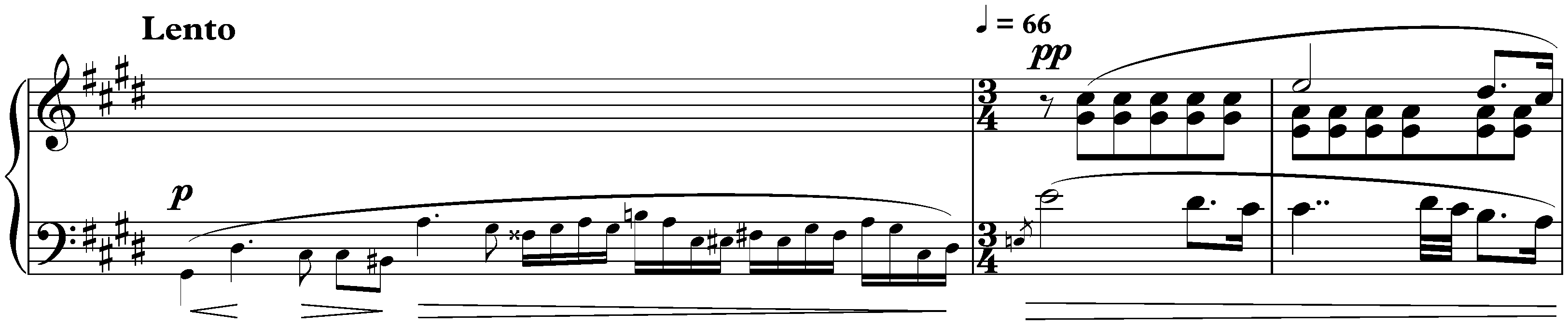 Twelve Études, op. 25; 7. C-sharp minor