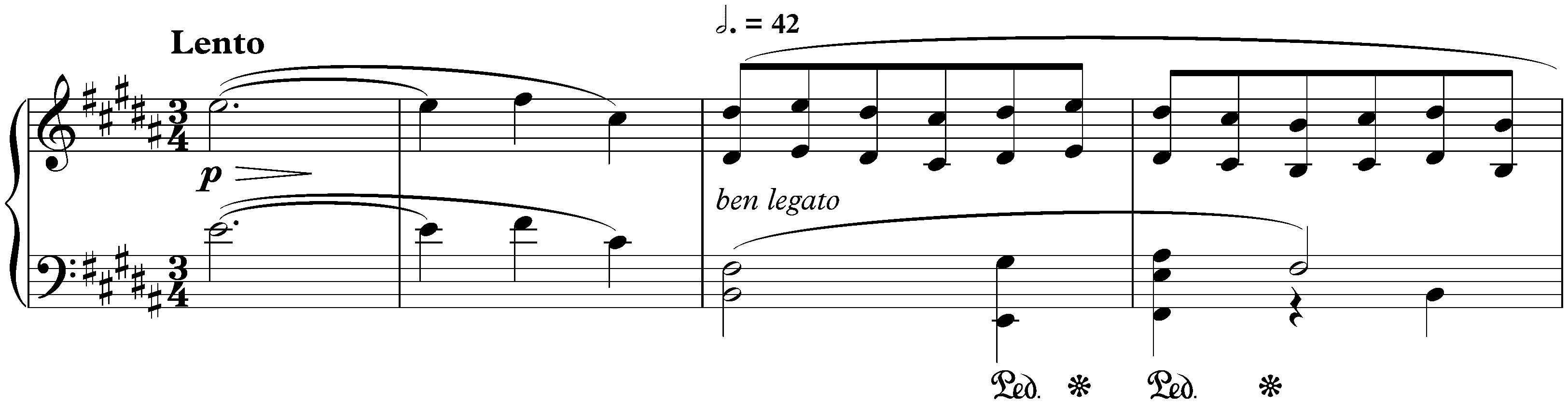 Twelve Études, op. 25; 10. B minor