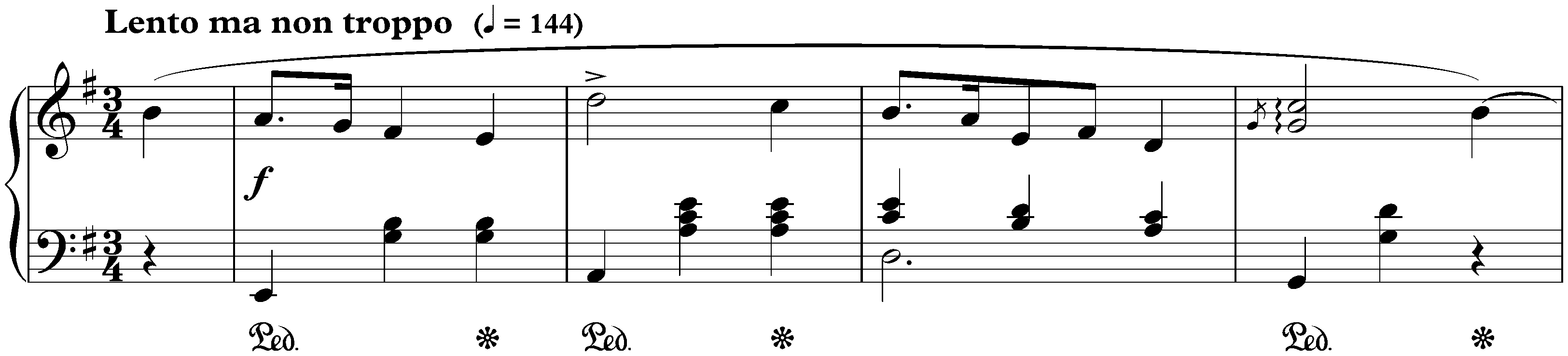 Four Mazurkas, op. 17; 2. E minor