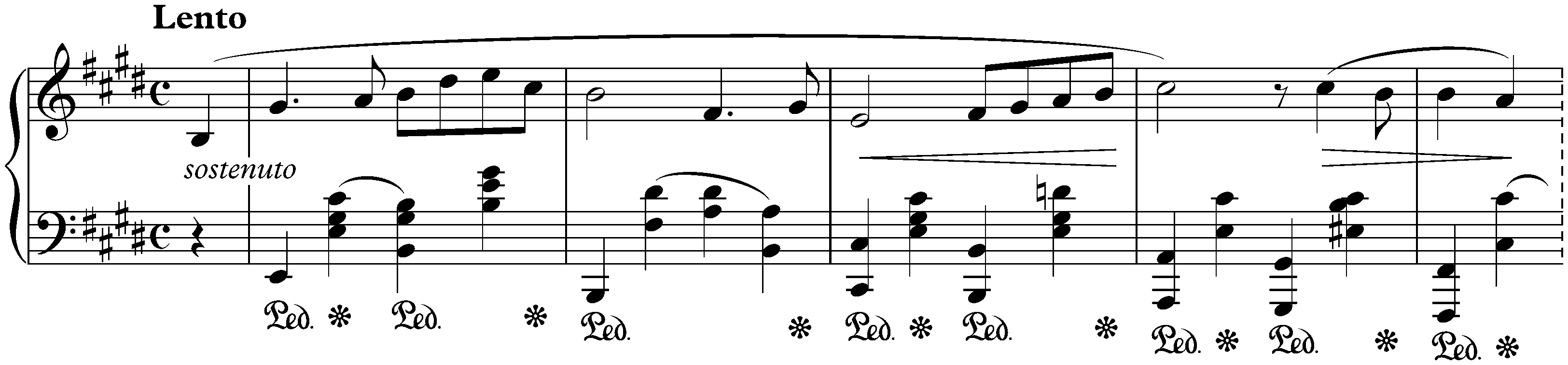 Two Nocturnes, op. 62; 2. E major