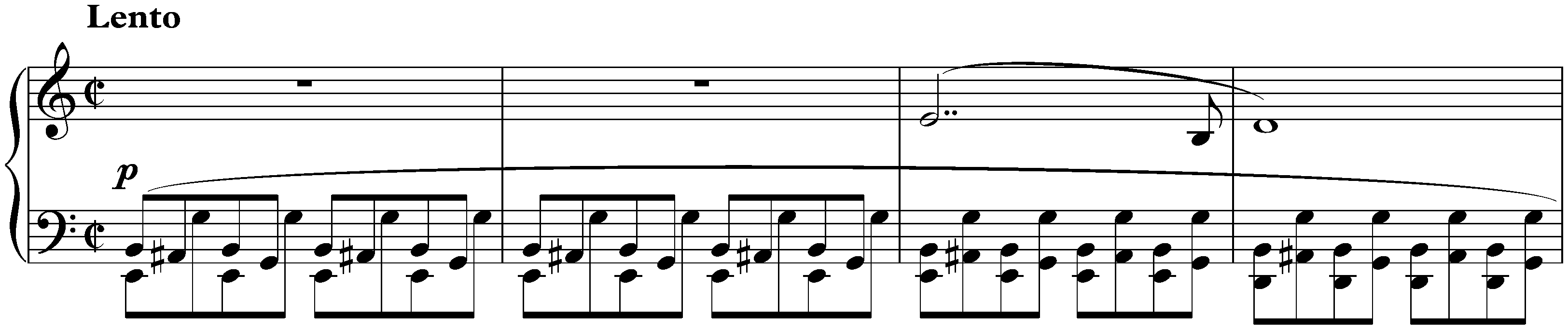 Twenty-four Préludes, op. 28; 2. A minor