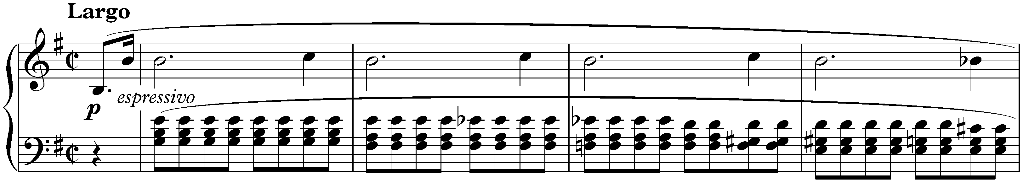 Twenty-four Préludes, op. 28; 4. E minor