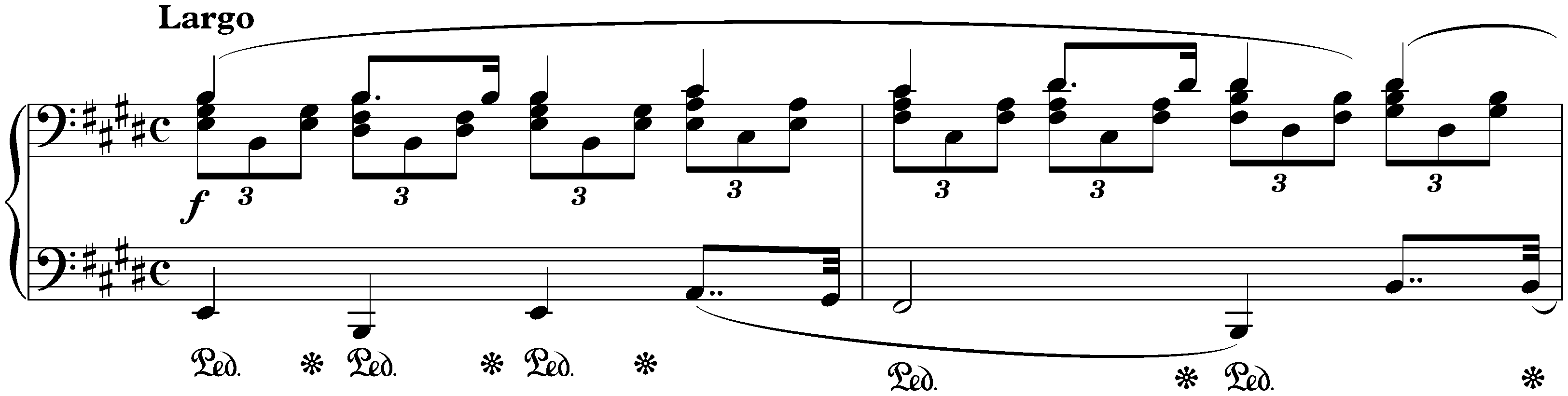 Twenty-four Préludes, op. 28; 9. E major