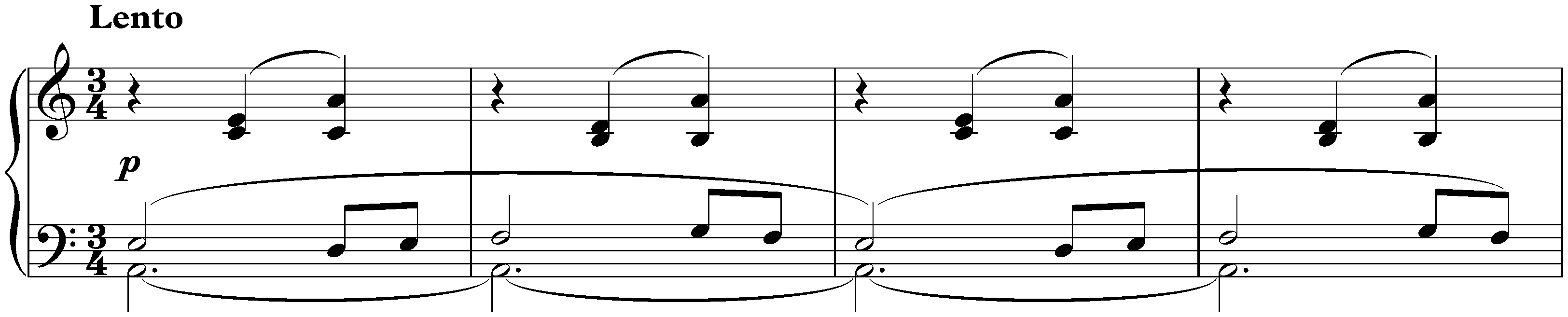 Three Valses, op. 34; 2. A minor