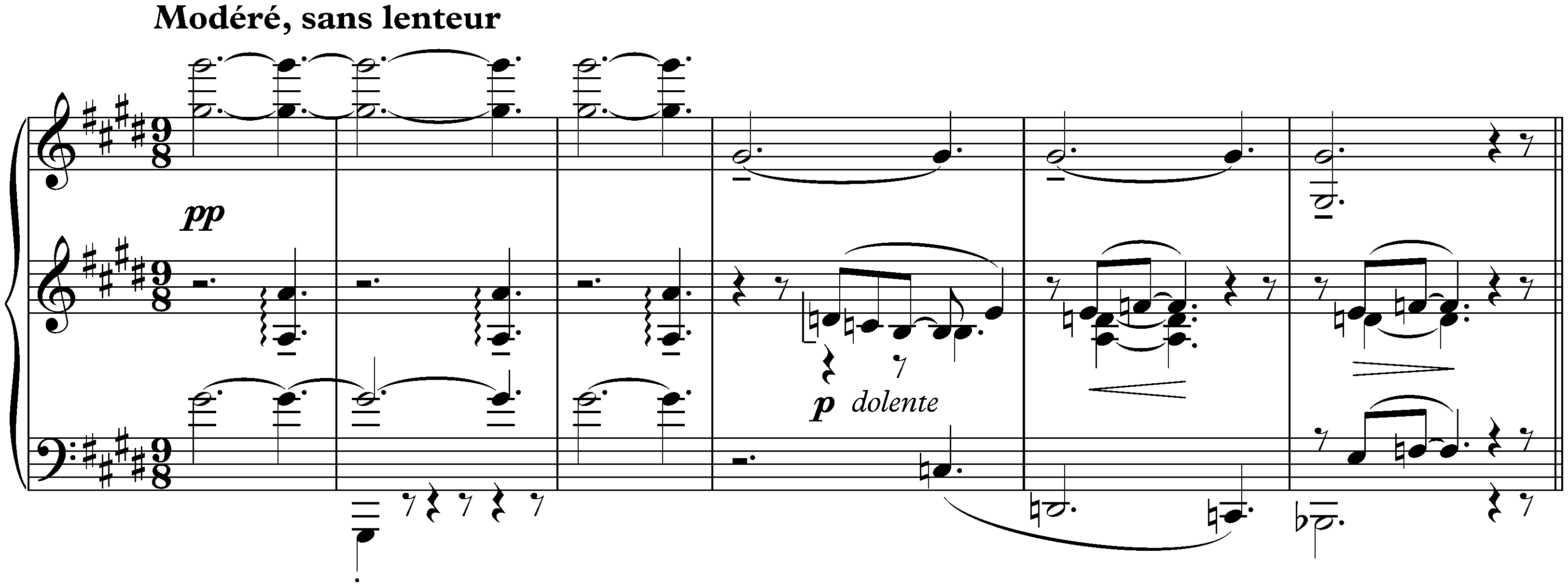 Douze Études; 10. Pour les sonorités opposées