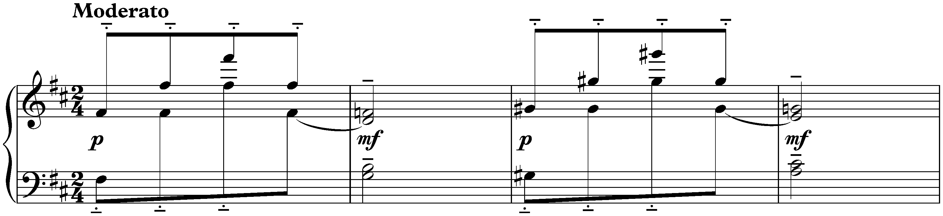 Intermède