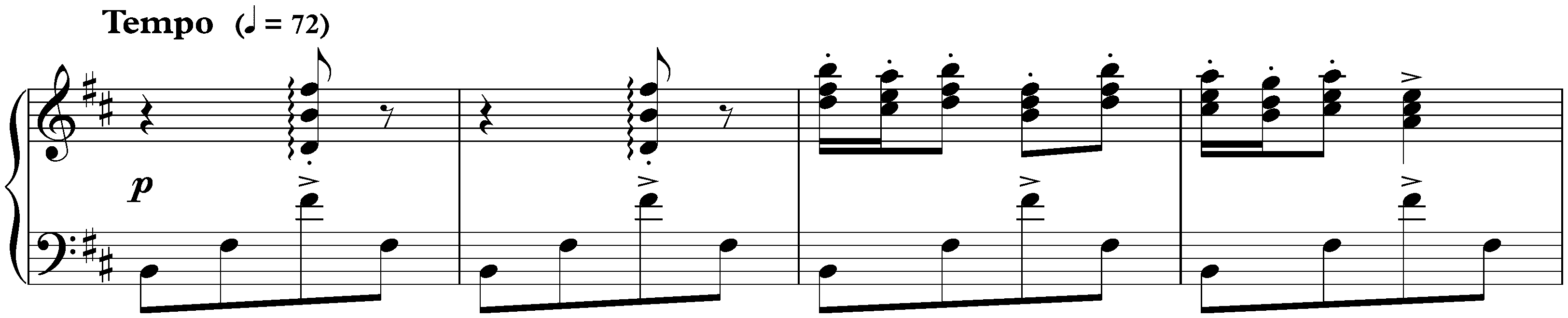 Intermède