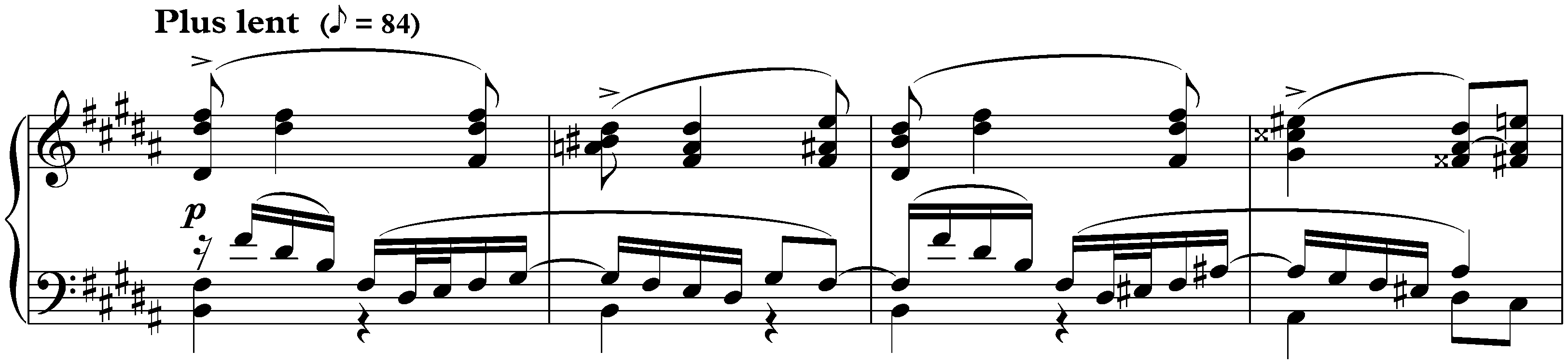Intermède