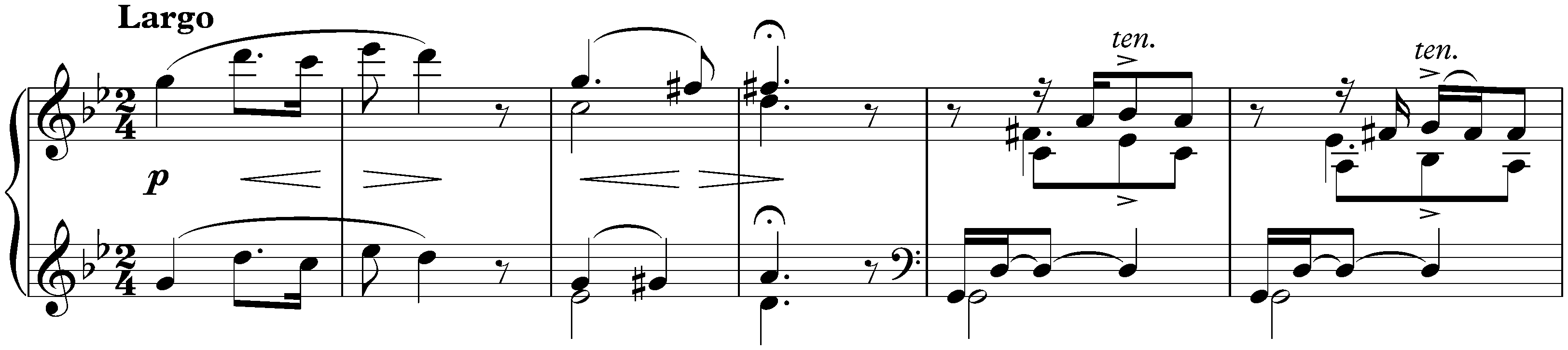 Lyric Pieces, Book 4, op. 47; 5. Melancholy