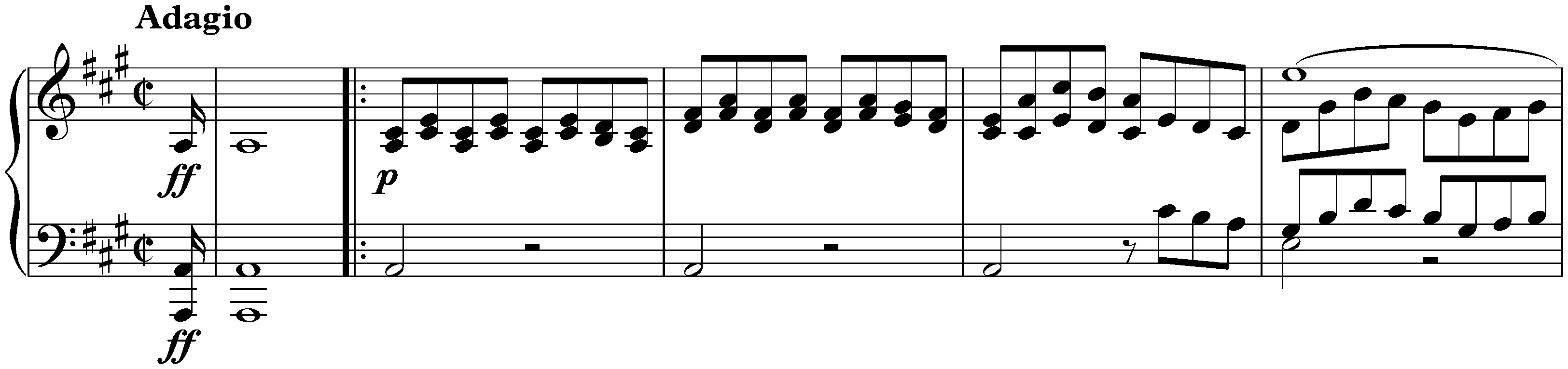 Die Sieben letzten Worte unseres Erlösers am Kreuze, Hob. XX:1C; 6. (5.) Sonata V (Sitio)