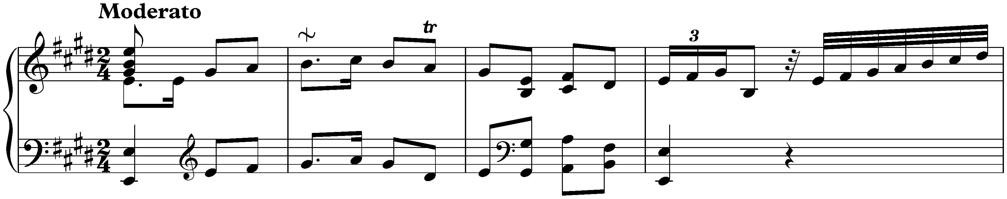 Sonata in E major, Hob. XVI:13; 1. Moderato