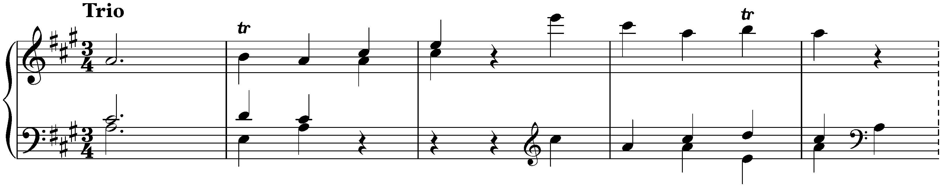 Sonata in A major, Hob. XVI:26; 2. Menuet al Rovescio – Trio