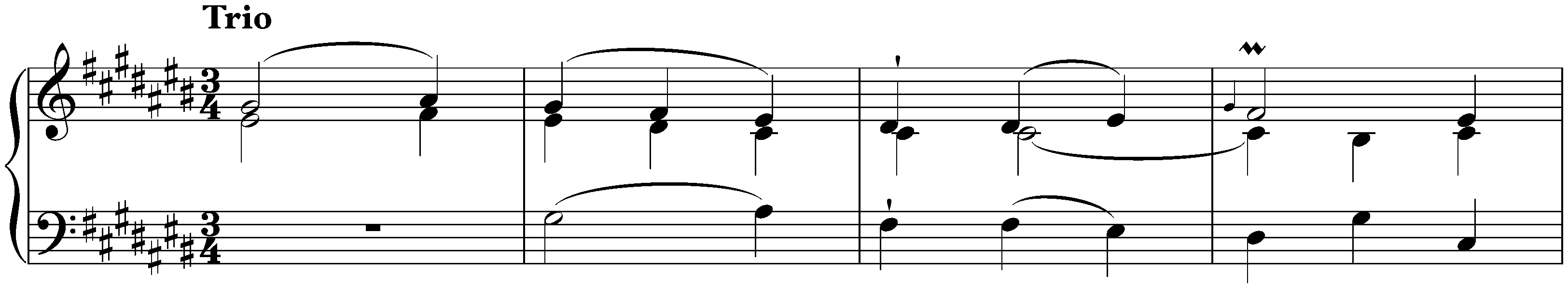 Sonata in C-sharp minor, Hob. XVI:36; 3. Menuet – Trio
