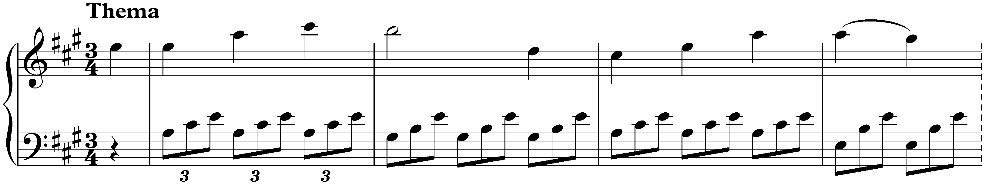 Variations in A major, Hob. XVII:2