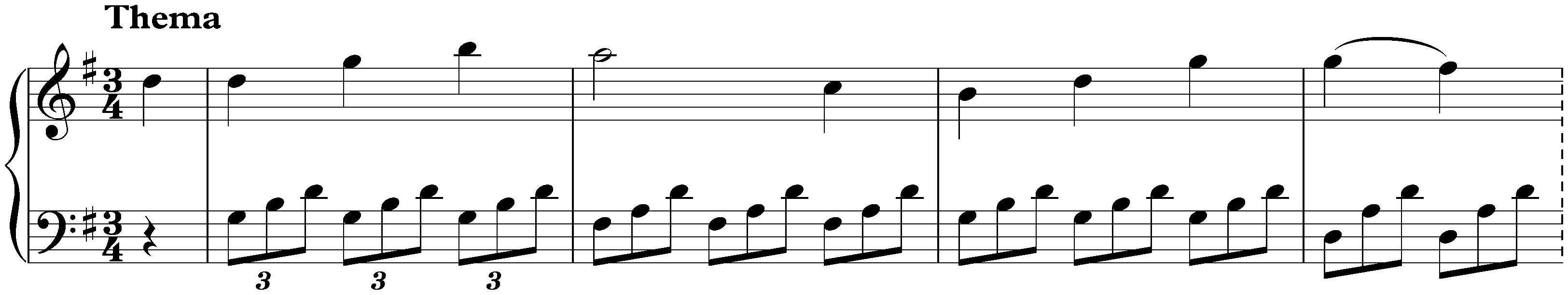 Variations in A major, Hob. XVII:2