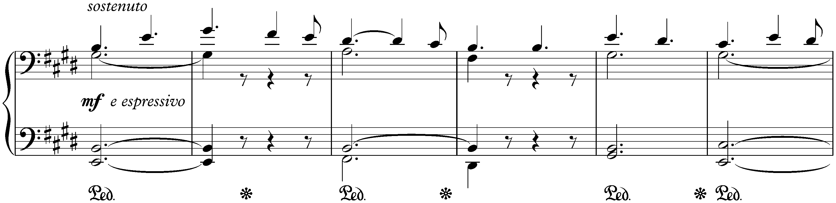 Angelus! (Prière à l’ange gardien), S. 162a/v