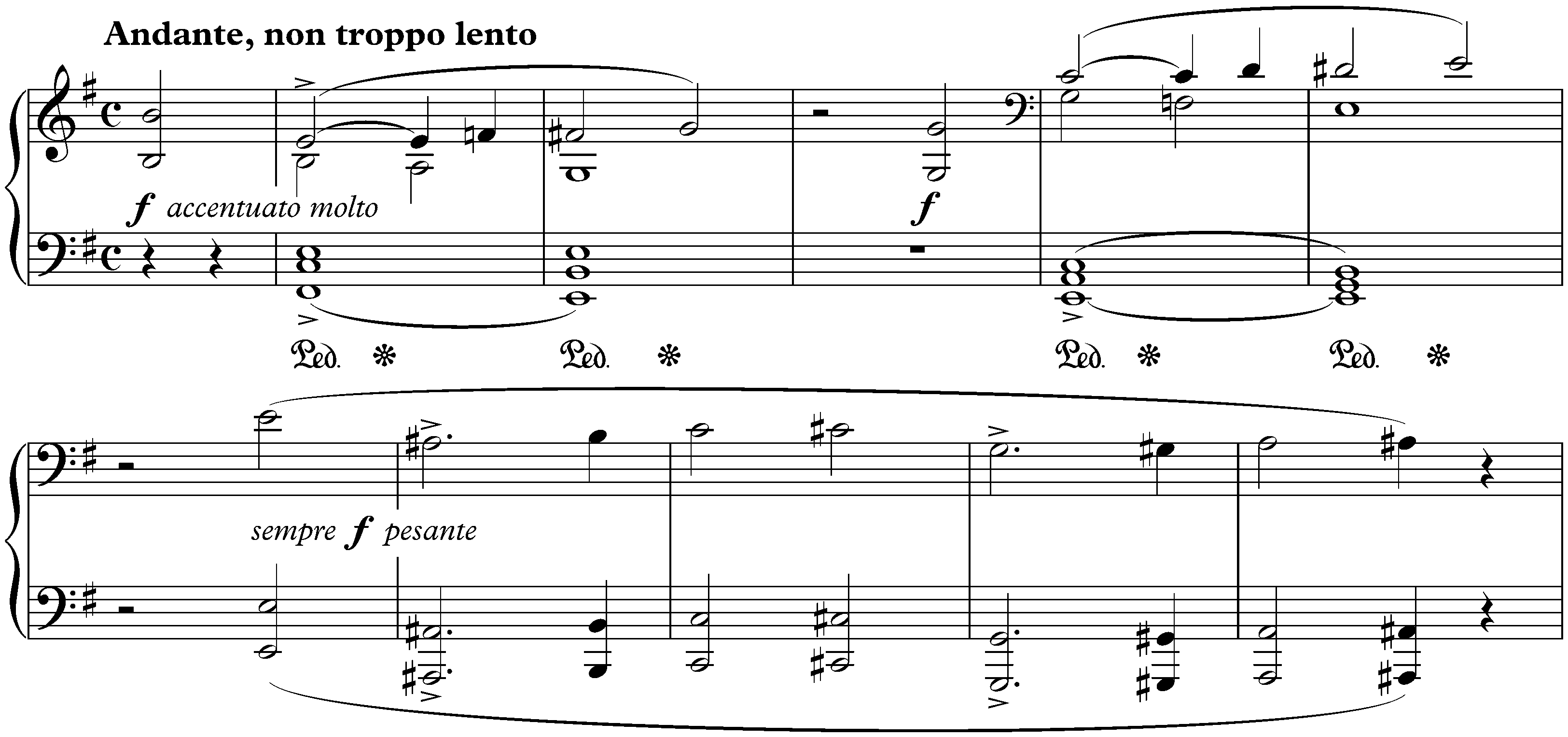 Années de pèlerinage, Troisième année, S. 163; 3. Aux cyprès de la Villa d’Este (Thrénodie II)