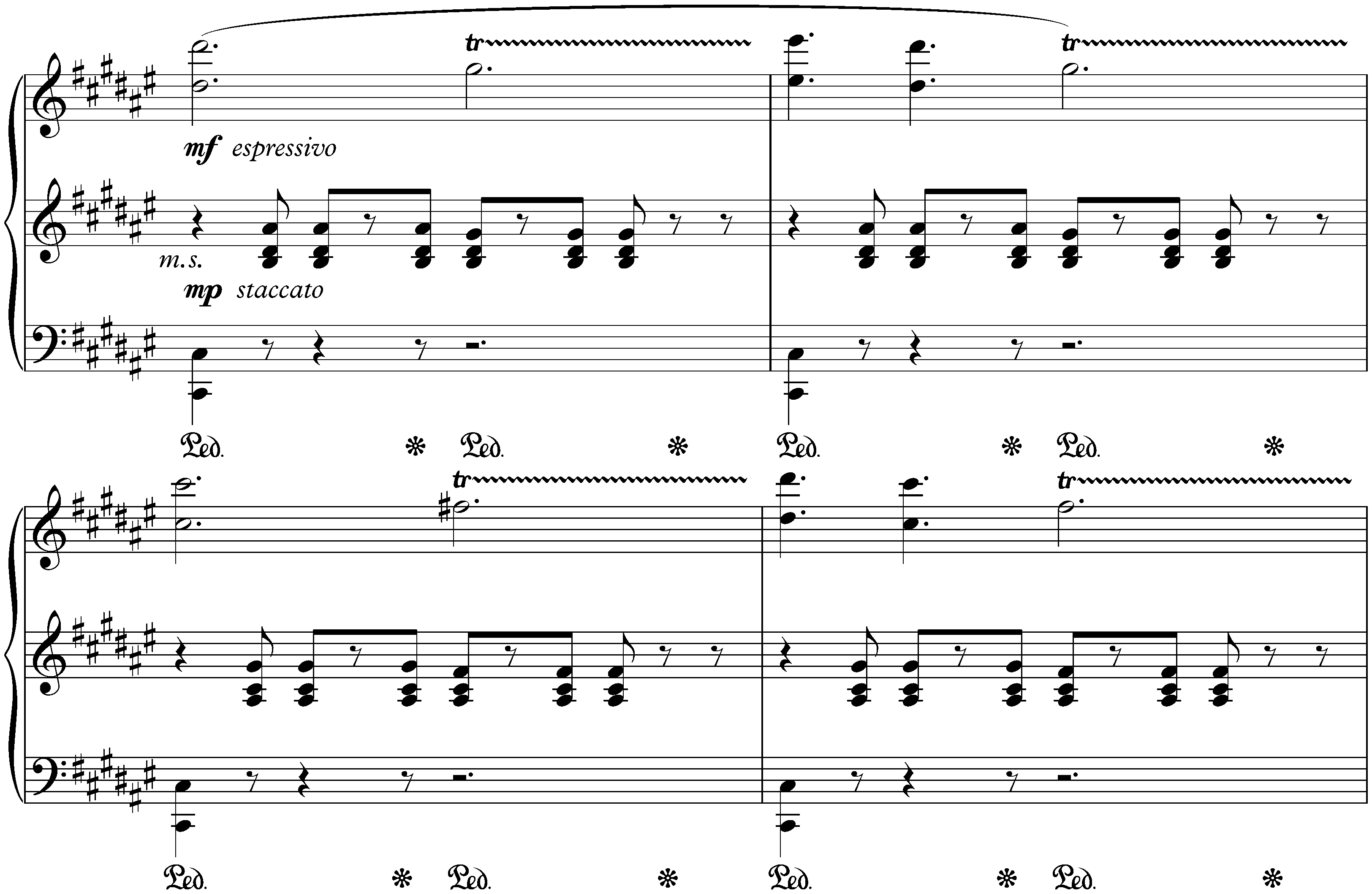 Dritter Mephisto-Walzer, S. 215a