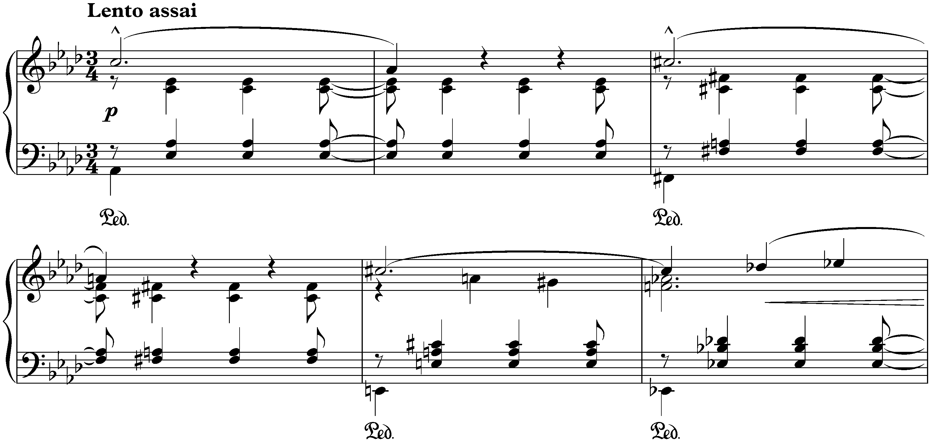 Fünf Klavierstücke, S. 192; 2. Lento assai