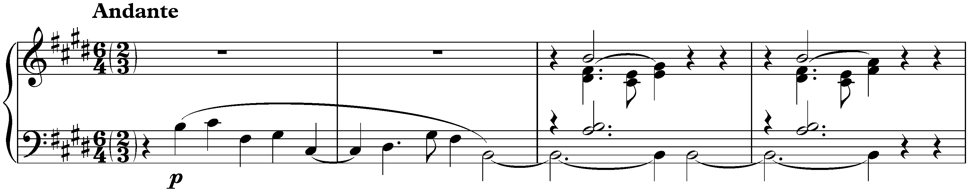 Sposalizio, S. 157a