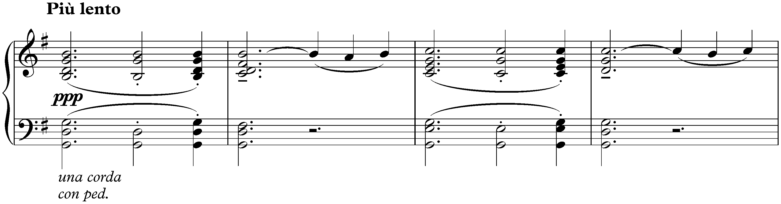 Sposalizio, S. 157a