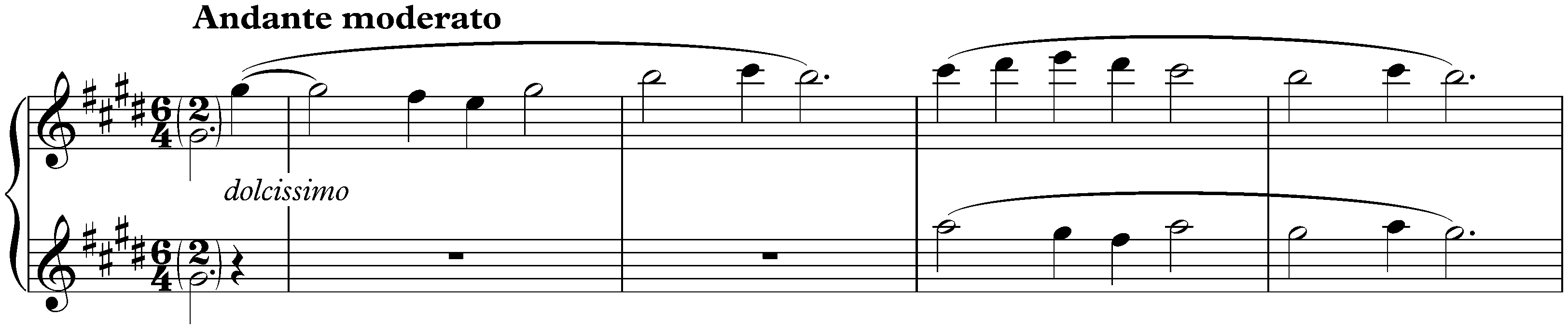 Drei Stücke aus der Legende von der heiligen Elisabeth, S. 498a; 1. Orchester Einleitung