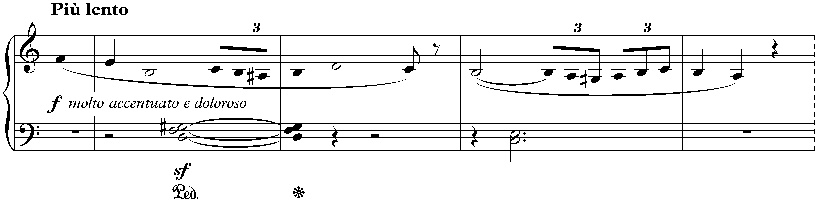 Sunt lacrymae rerum (en mode hongrois), S. 162c/i