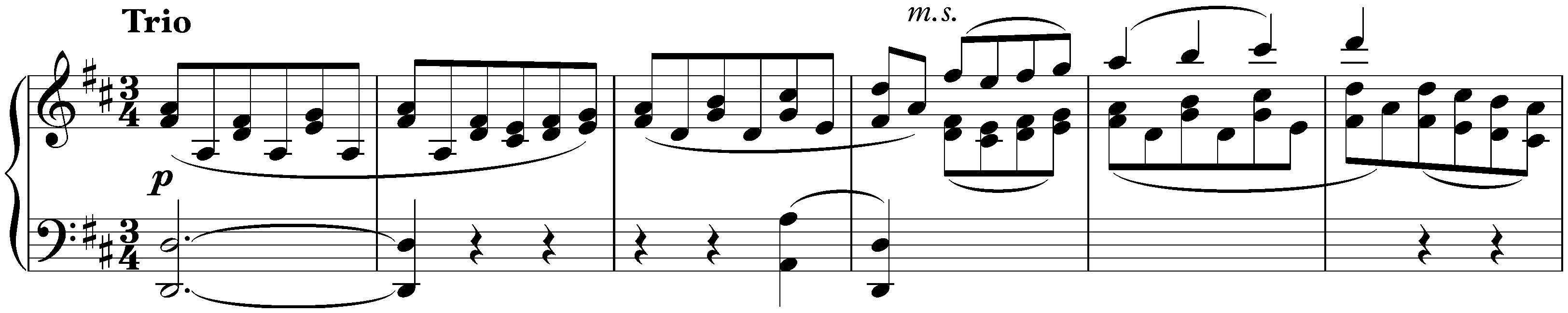 Sonata in A major, KV 331/300i; 2. Menuetto