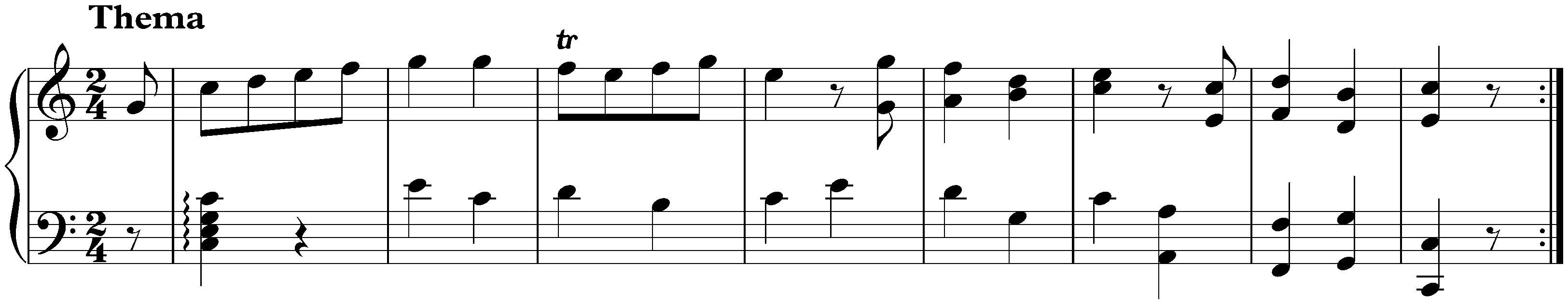 Variations on Lison dormait, KV 264/315d