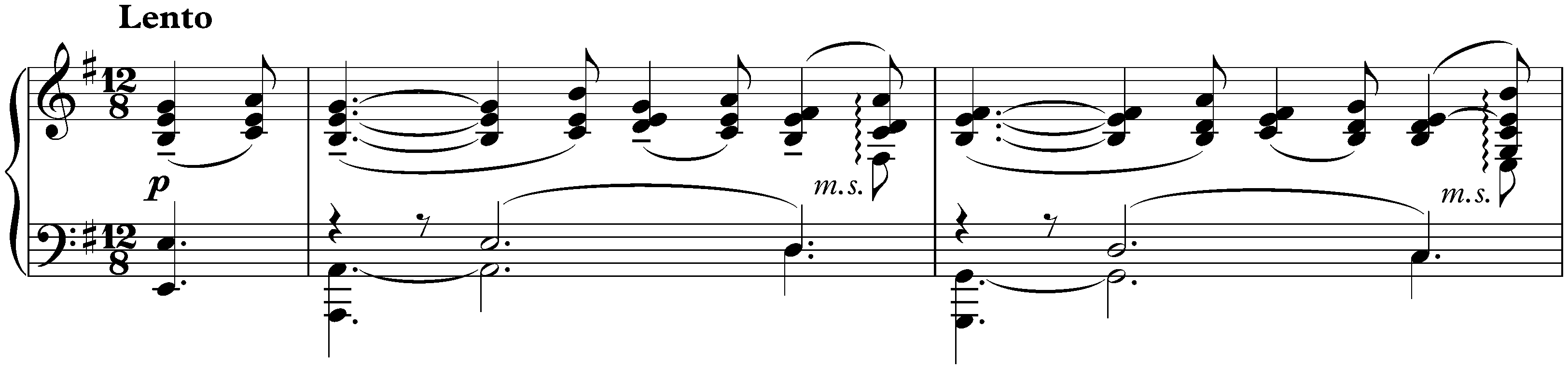 Sonata no. 2 in B-flat minor, op. 36 (first version); 2. Non allegro &ndash; Lento