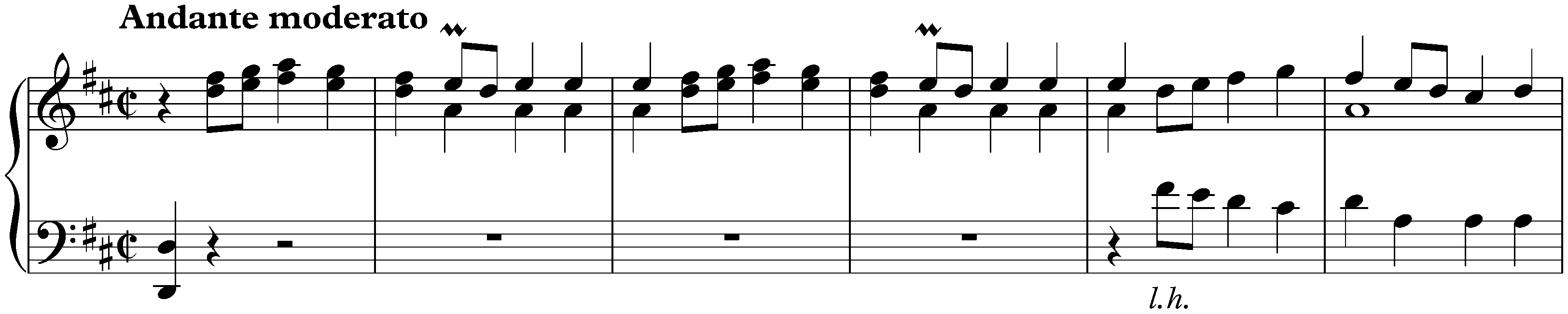 Sonata in D major, K. 177