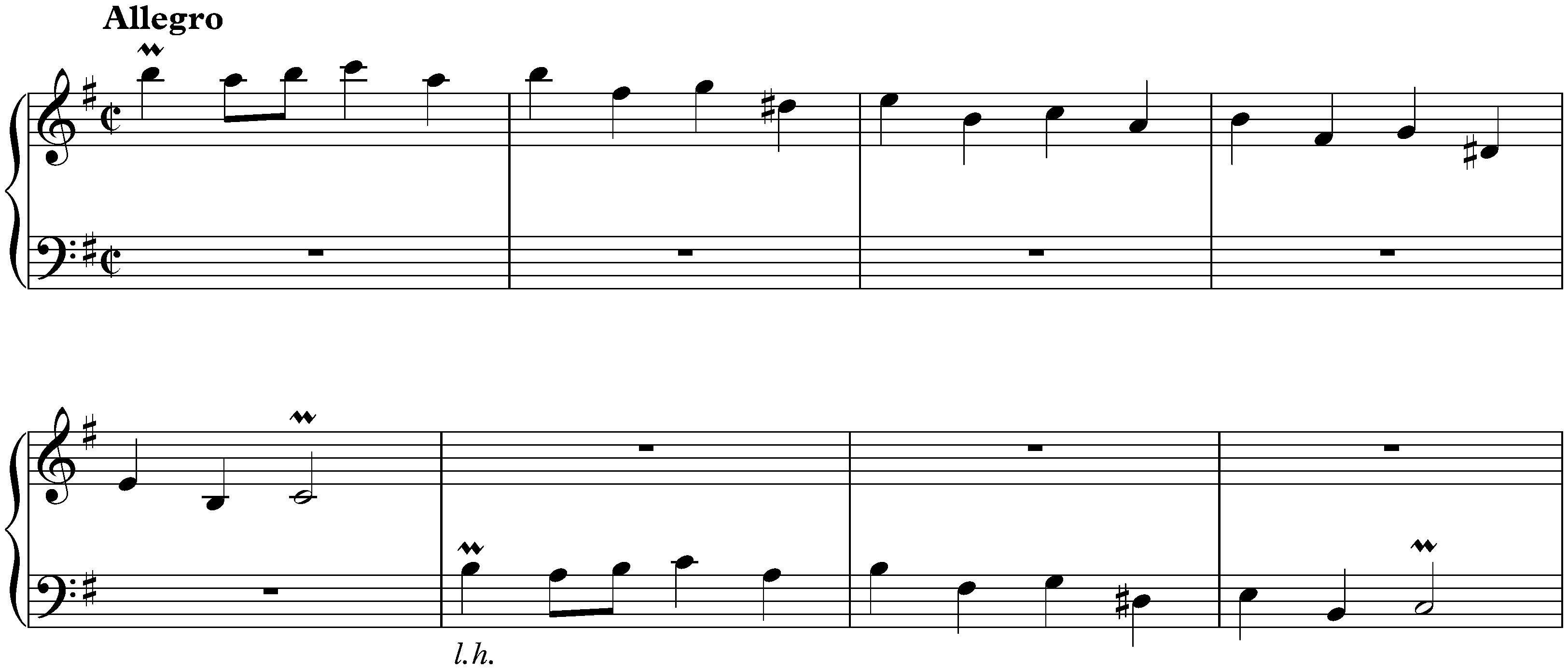 Sonata in E minor, K. 394
