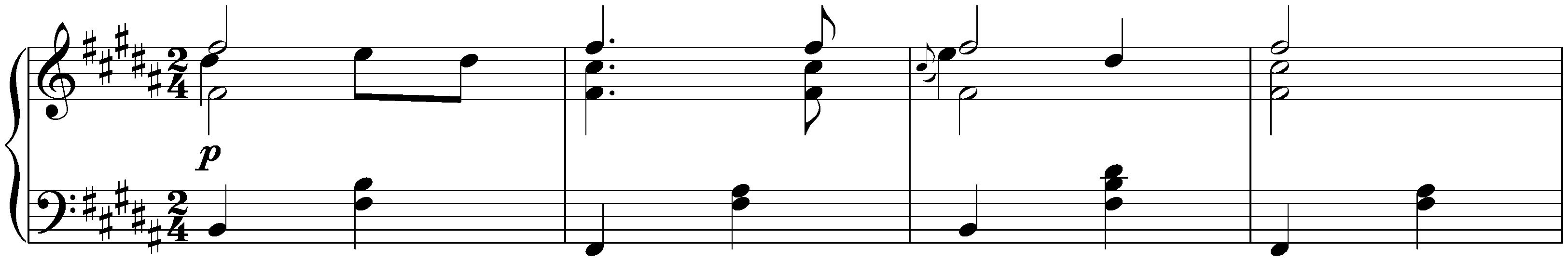 Twelve Ecossaises, D 781; 10. B major