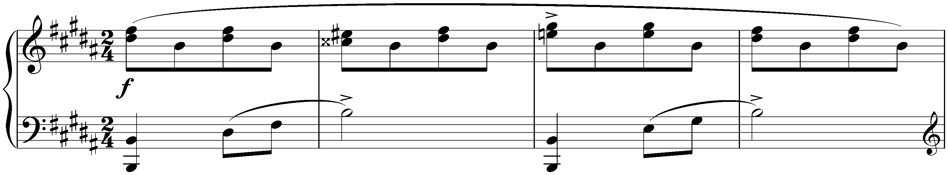 Eight Ecossaises, D 977; 4. B major