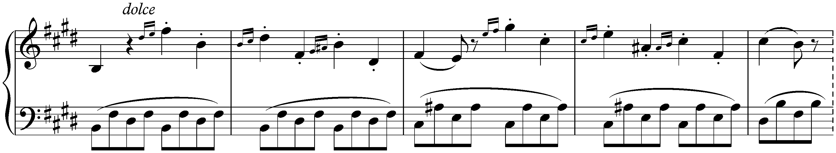 Sonata in E major, D 157; 1. Allegro ma non troppo