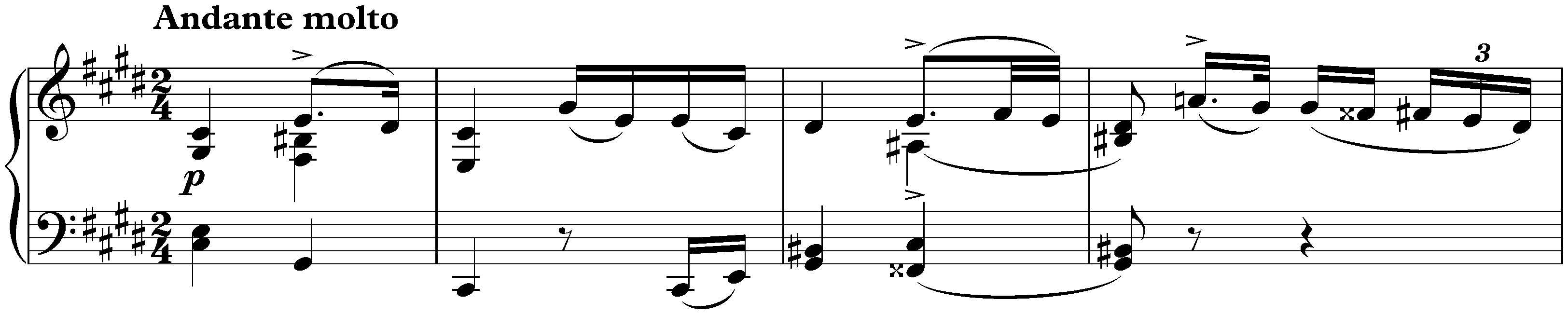 Sonata in D-flat major, D 567; 2. Andante molto