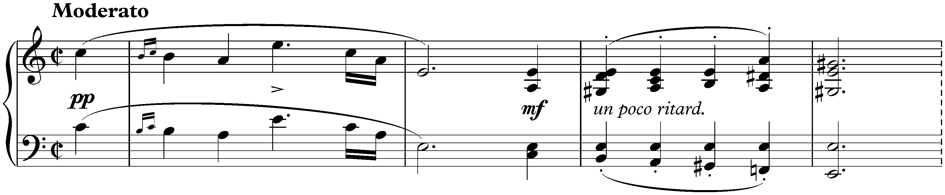 Sonata in A minor, D 845; 1. Moderato