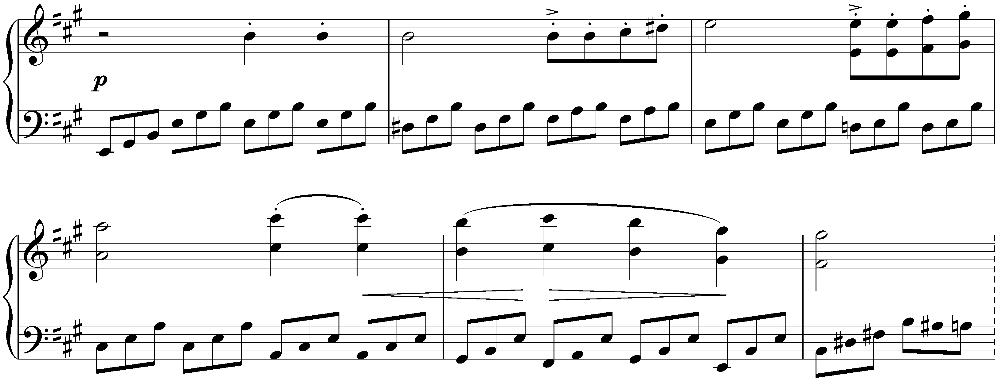 Sonata in A major, D 959; 4. Rondo: Allegretto