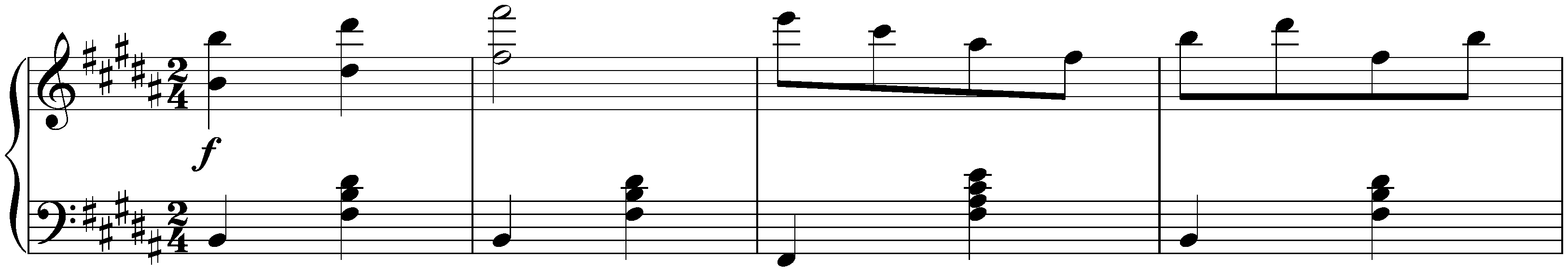 Twelve Waltzes, seventeen Ländler and nine Ecossaises, D 145; 34. Nine Ecossaises, no. 5 in B major