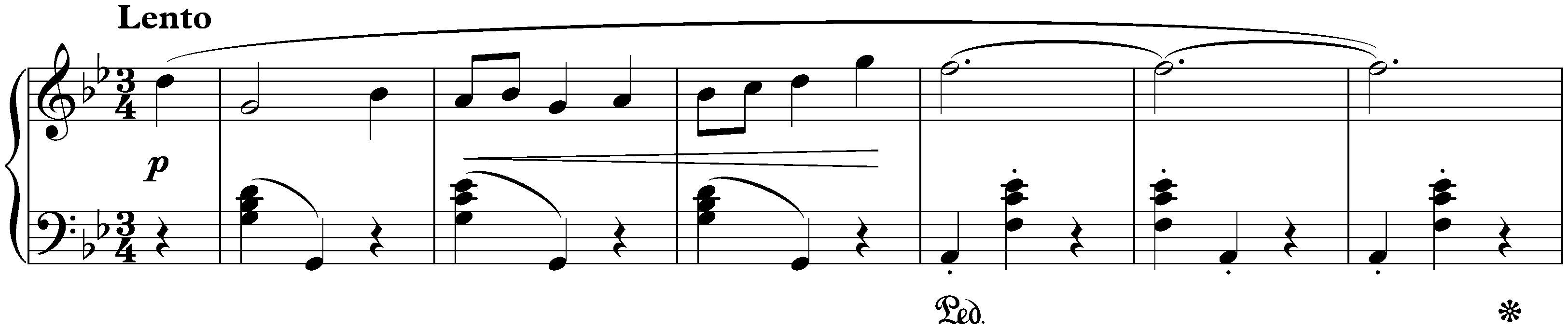 Variationen über ein Nocturne von Chopin, Anh. F26